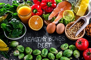 Nutrition for Knee Replacement Recovery: What to Eat Before and After Surgery